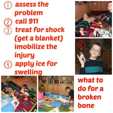 what to do for a broken bone